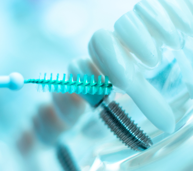 Stoughton Post-Op Care for Dental Implants
