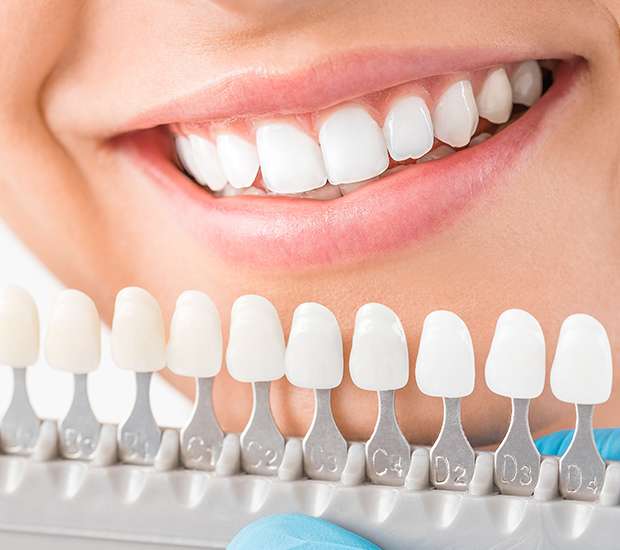 How Often Should an Adult Get a Deep Teeth Cleaning? - Dentistry on Park,  LLC Stoughton Massachusetts