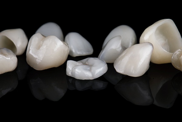 Dental Crowns: Their Purpose, Process, And Longevity