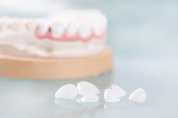 Dental Veneers: What They Treat And How Long Results Can Last