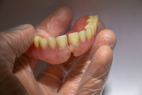 Denture Repair When They Break