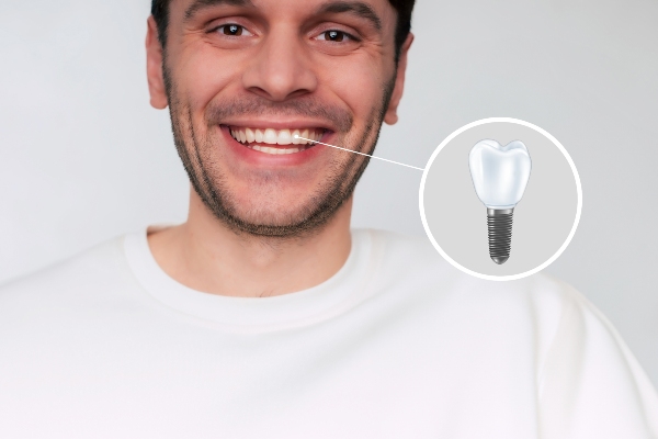 How An Implant Dentist Can Benefit Your Oral Health