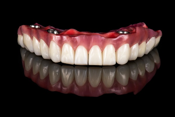 Implant Supported Dentures: Secure, Comfortable, And Natural Looking Smiles