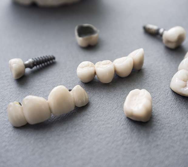 Stoughton The Difference Between Dental Implants and Mini Dental Implants