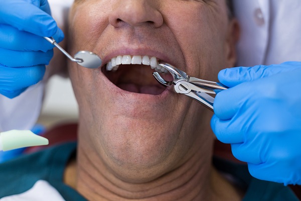 What To Expect During A Tooth Extraction: A Guide To A Smooth Recovery